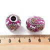 Handmade Indonesia Beads FIND-Q106-03B-3